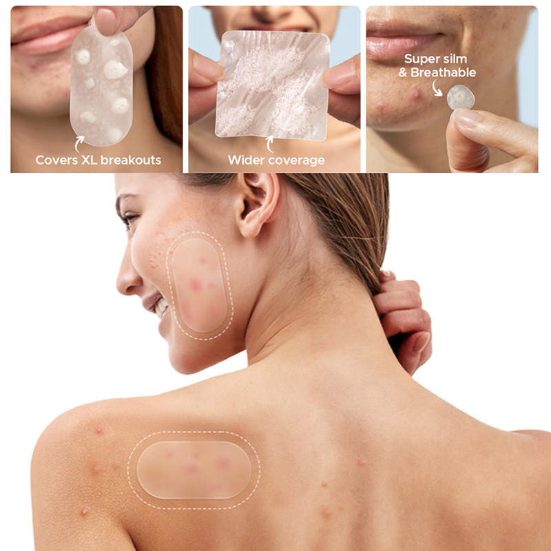 116Pcs Anti-Acne Patches Spots - Beauty And Makeup Quotes recension och pris