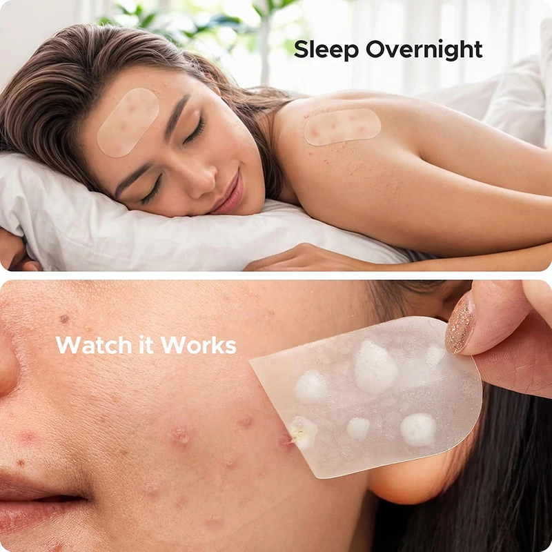 116Pcs Anti-Acne Patches Spots - Beauty And Makeup Quotes recension och pris